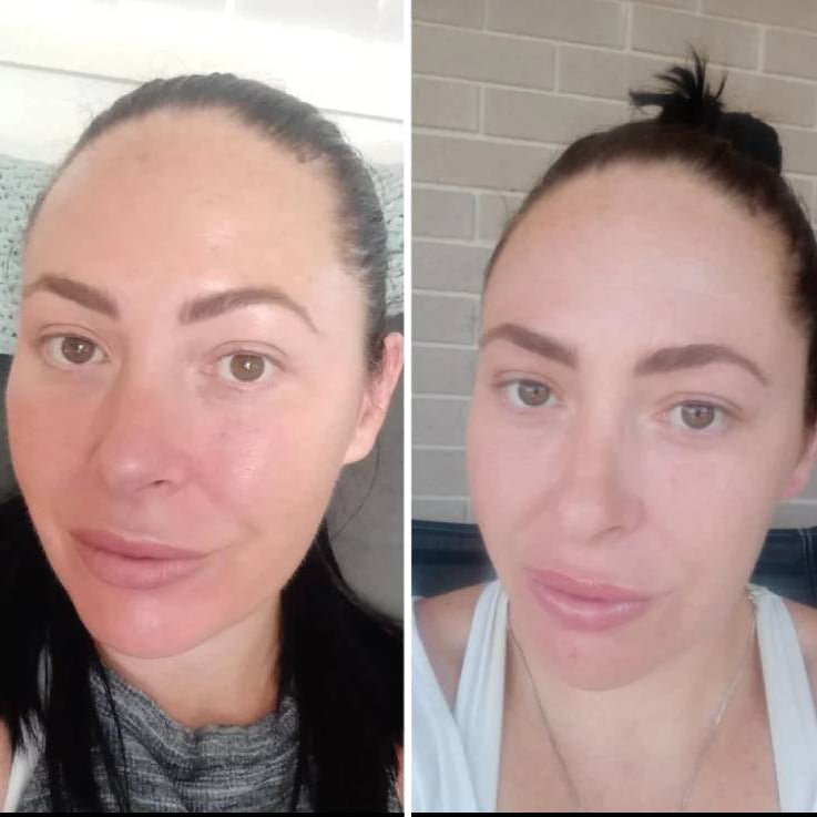 LED Face Mask Light Therapy Skincare Device